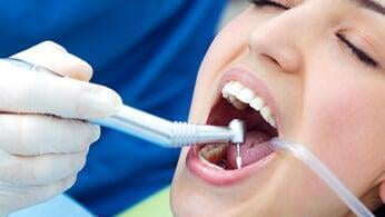 Endodontics(long term)